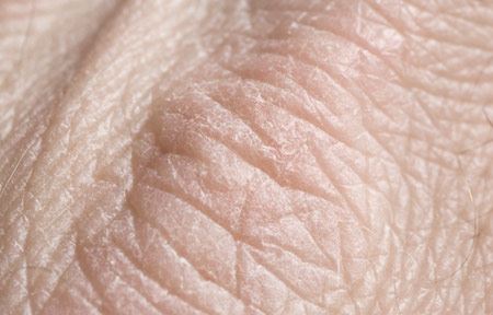 wwwwwskin 03